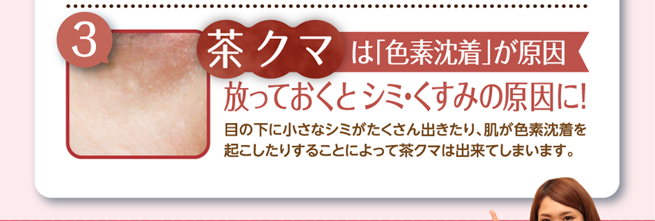 茶クマはは「色素沈着」が原因放っておくとシミ・くすみの原因に！