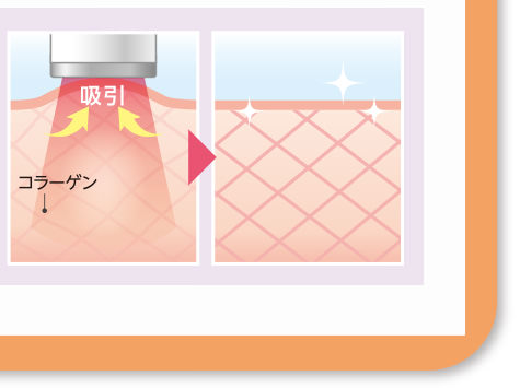 LED吸引マシン