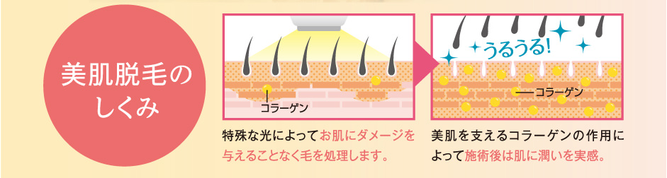 美肌脱毛のしくみ