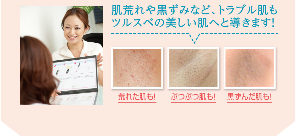 経験豊富なカウンセラーがトラブル肌も「美肌」へと導きます！