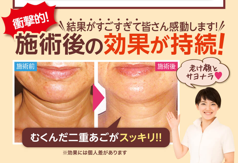 施術後の効果が持続！結果がすごすぎて皆さん感動します！