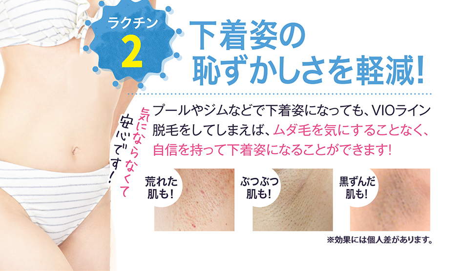 下着姿の恥ずかしさを軽減！　プールやジムなどで下着姿になっても、VIOライン脱毛をしてしまえば、ムダ毛を気にすることなく、自信を持って下着姿になることができます！黒ずんだ肌も！ぶつぶつ肌も！荒れた肌も！気にならなくて安心です！※効果には個人差があります。